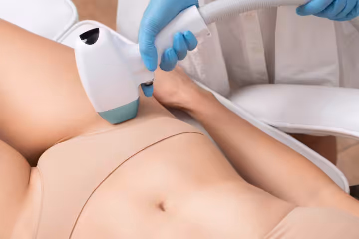 Dauerhafte Haarentfernung helle Haare